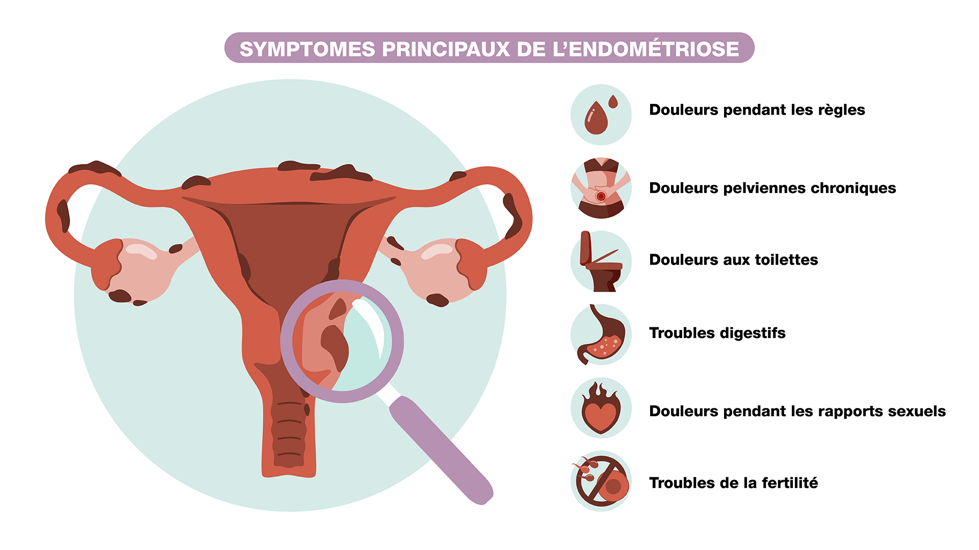 symptomes endométrioses